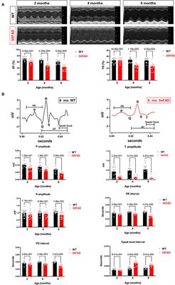 The Cardiac Dysfunction Caused by Metabolic Alterations in Alzheimer's Disease